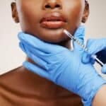 Botox and Fillers