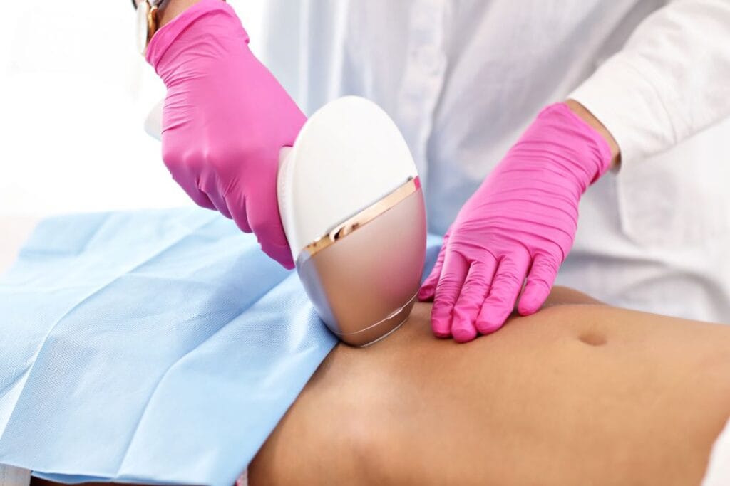 Laser Hair Removal